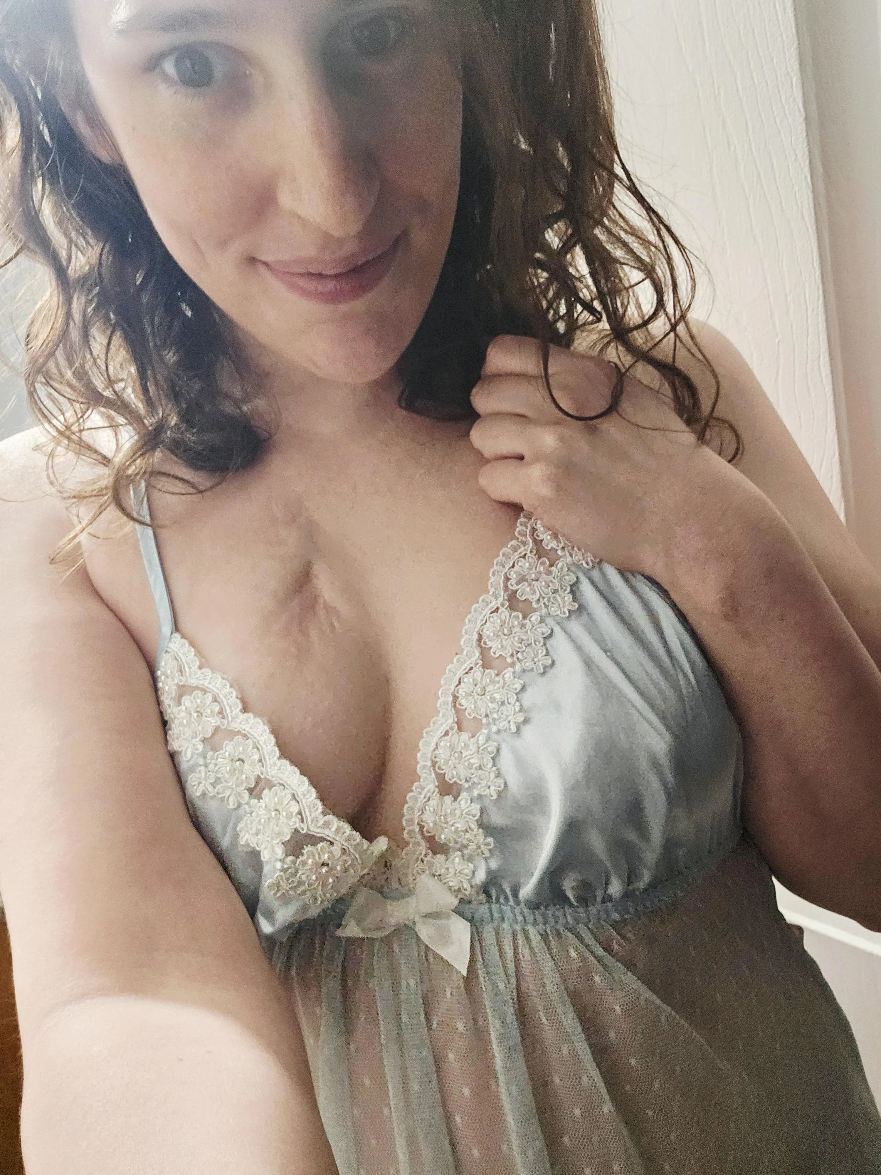 This scar has been with me since I was born.