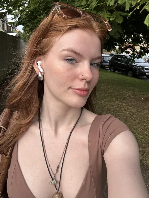 freckled and not sorry about it [IRTR]