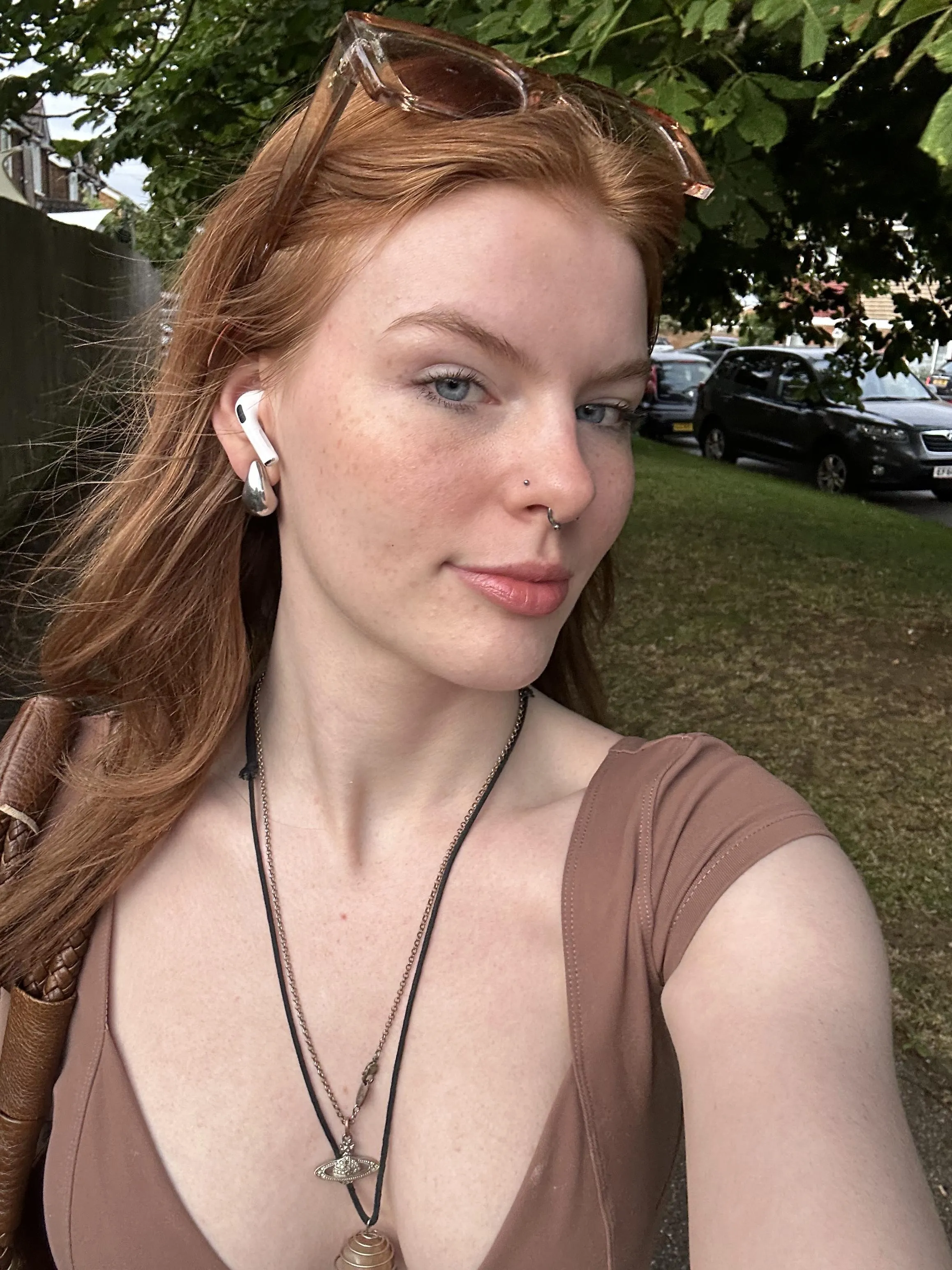 freckled and not sorry about it [IRTR]