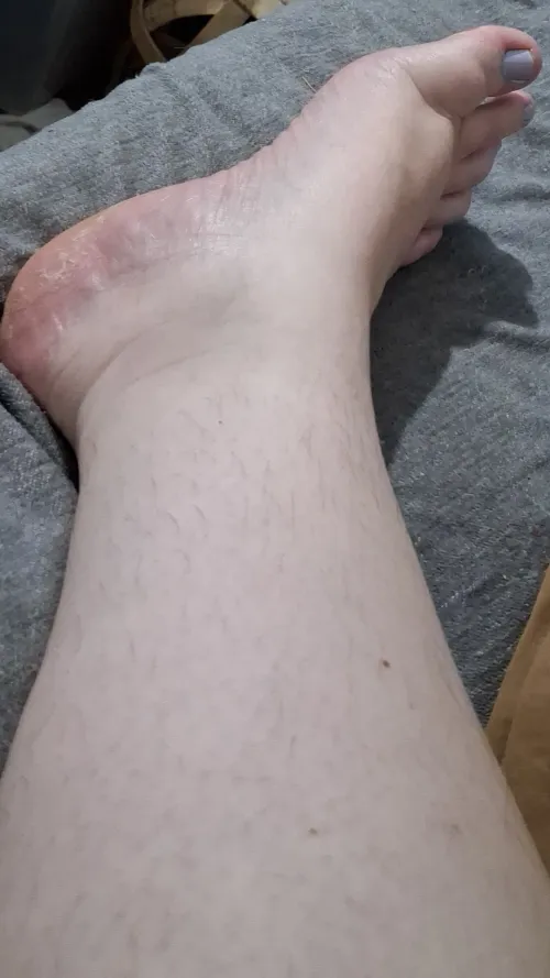 Purple nail polish and fuzzy legs