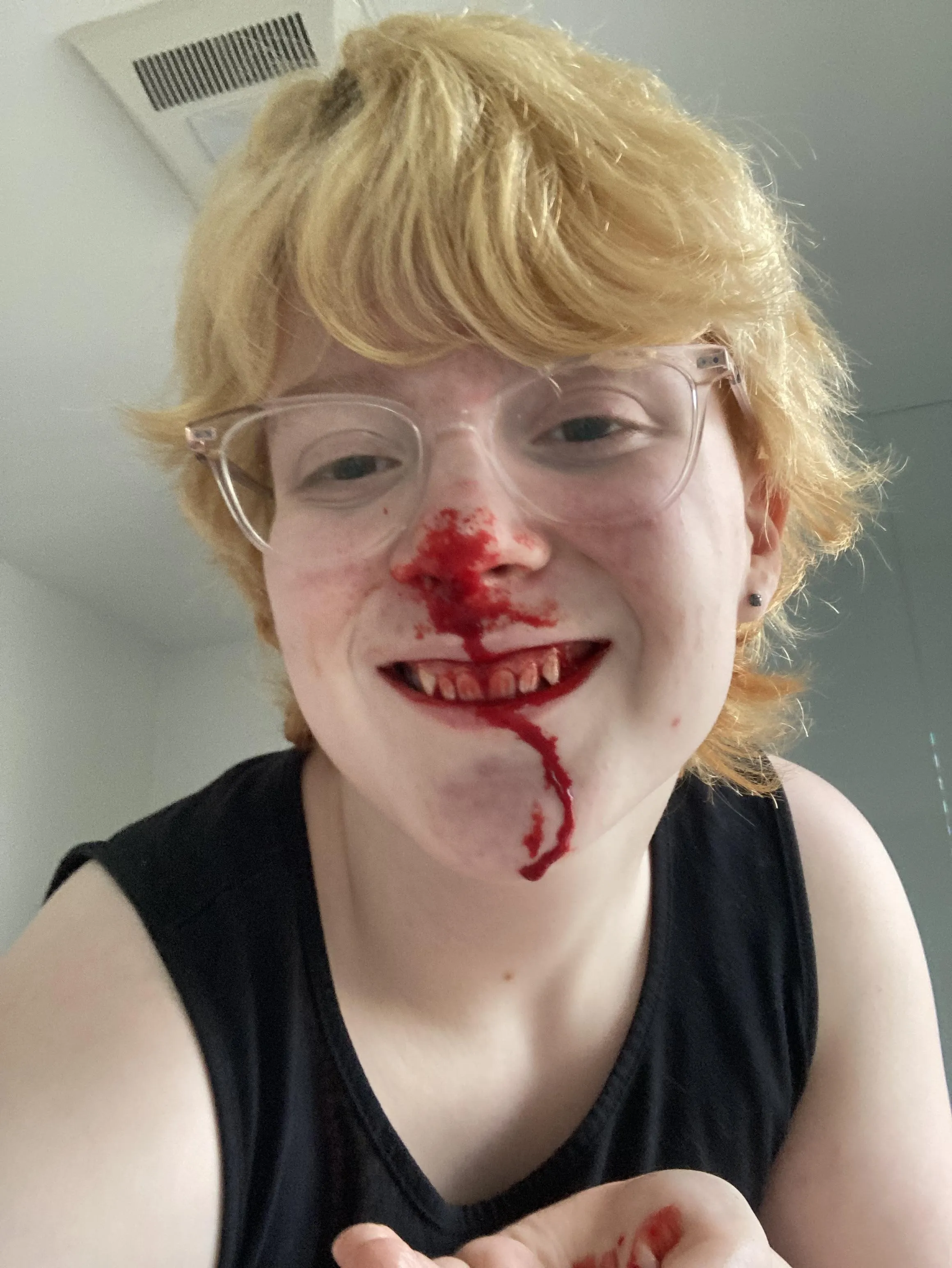 The magical effects of Claravis (highly drying medication)