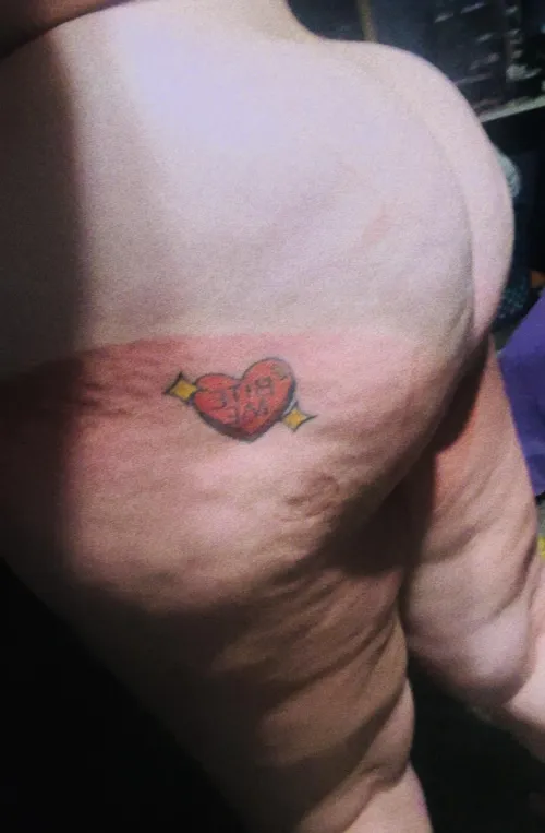 last sunburn of the summer