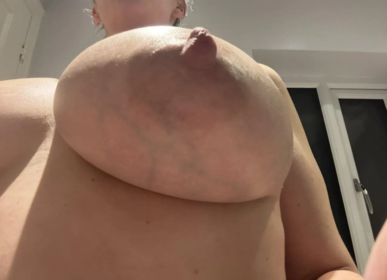 How about a Little under veins ;)