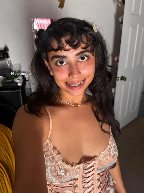 1 year with braces ✅