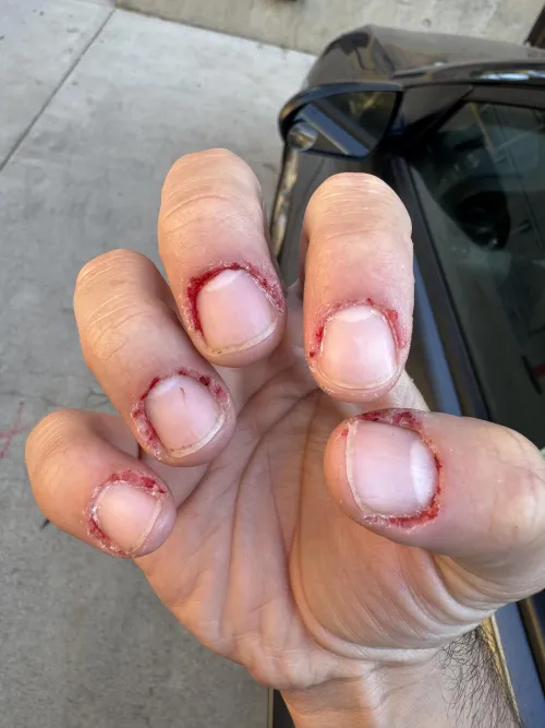 Bf loves to bite his fingers and is “proud of his work”