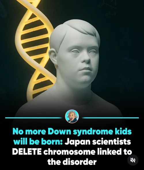 How are they gonna know if they have down syndrome or are just regular Japanese people
