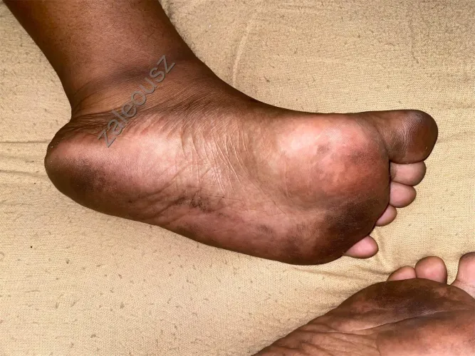 the big toe has the best flavor, I can tell