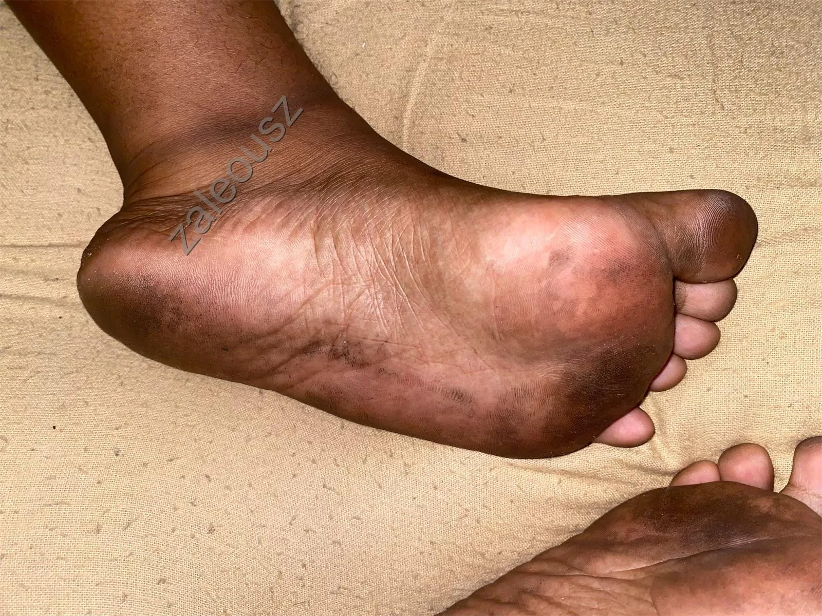 the big toe has the best flavor, I can tell