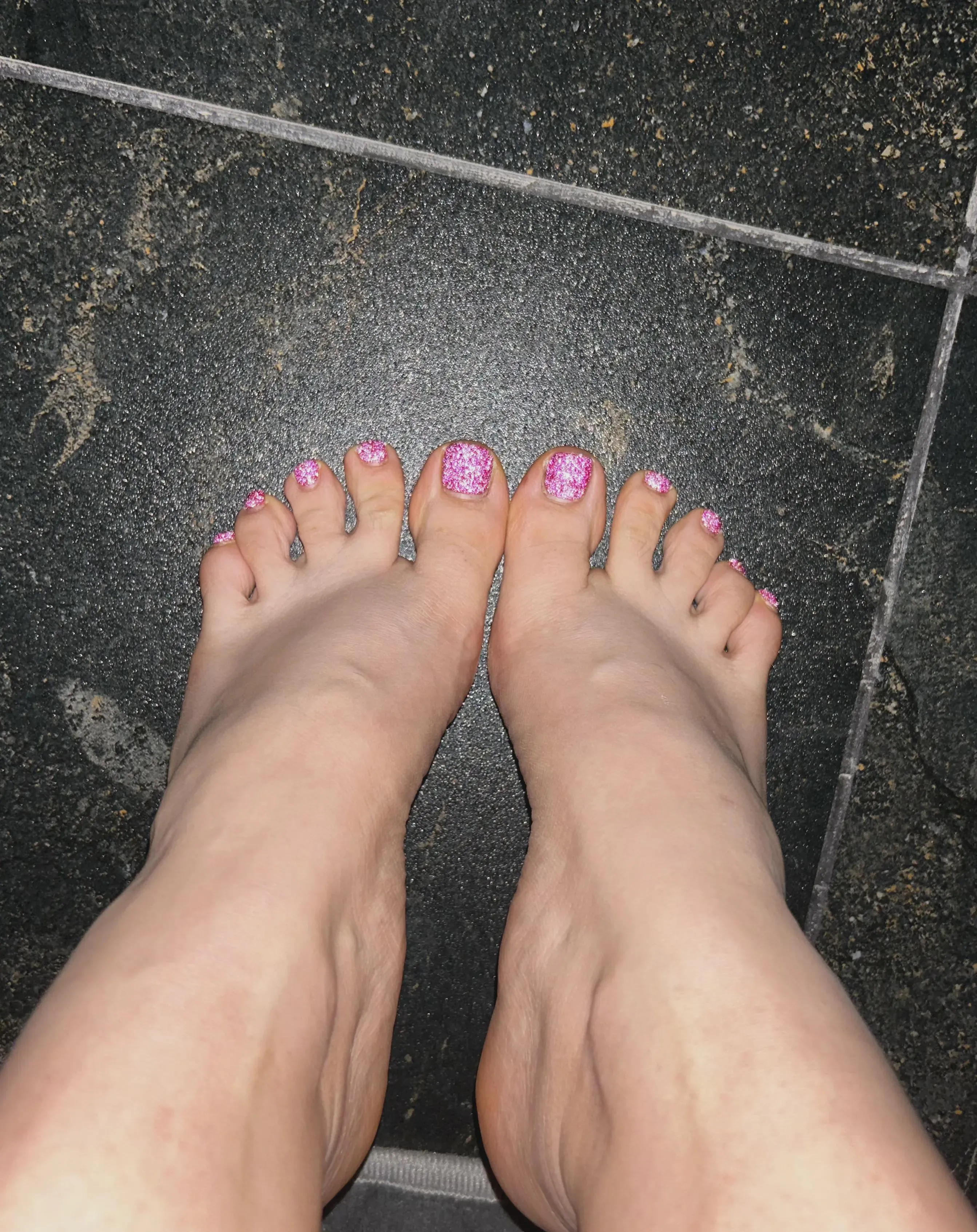 my exboyfriend said my toes were ugly