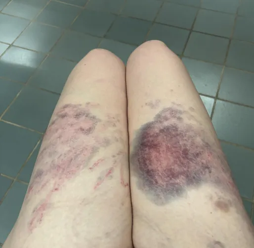 My thighs look so pretty like this