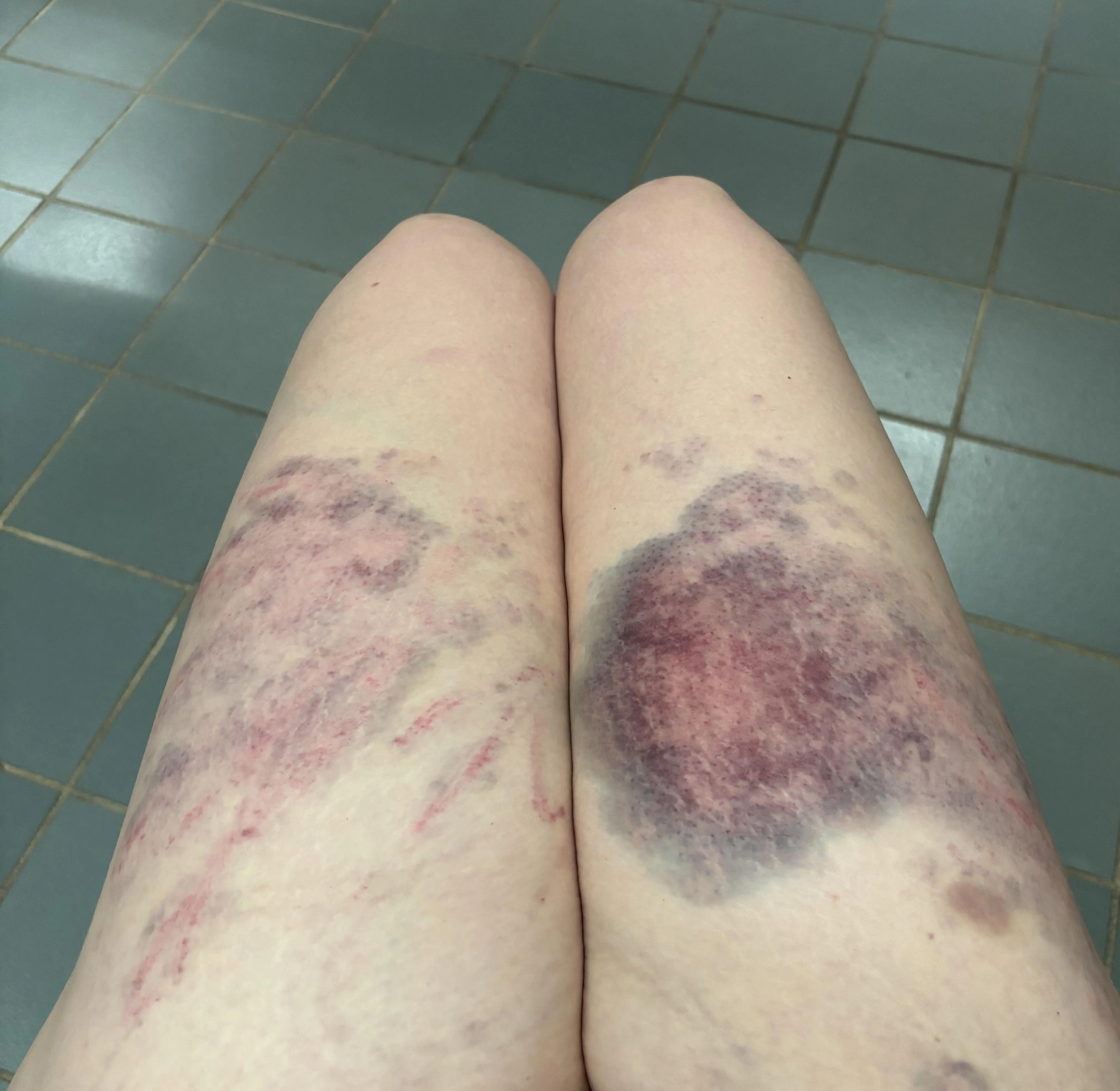 My thighs look so pretty like this