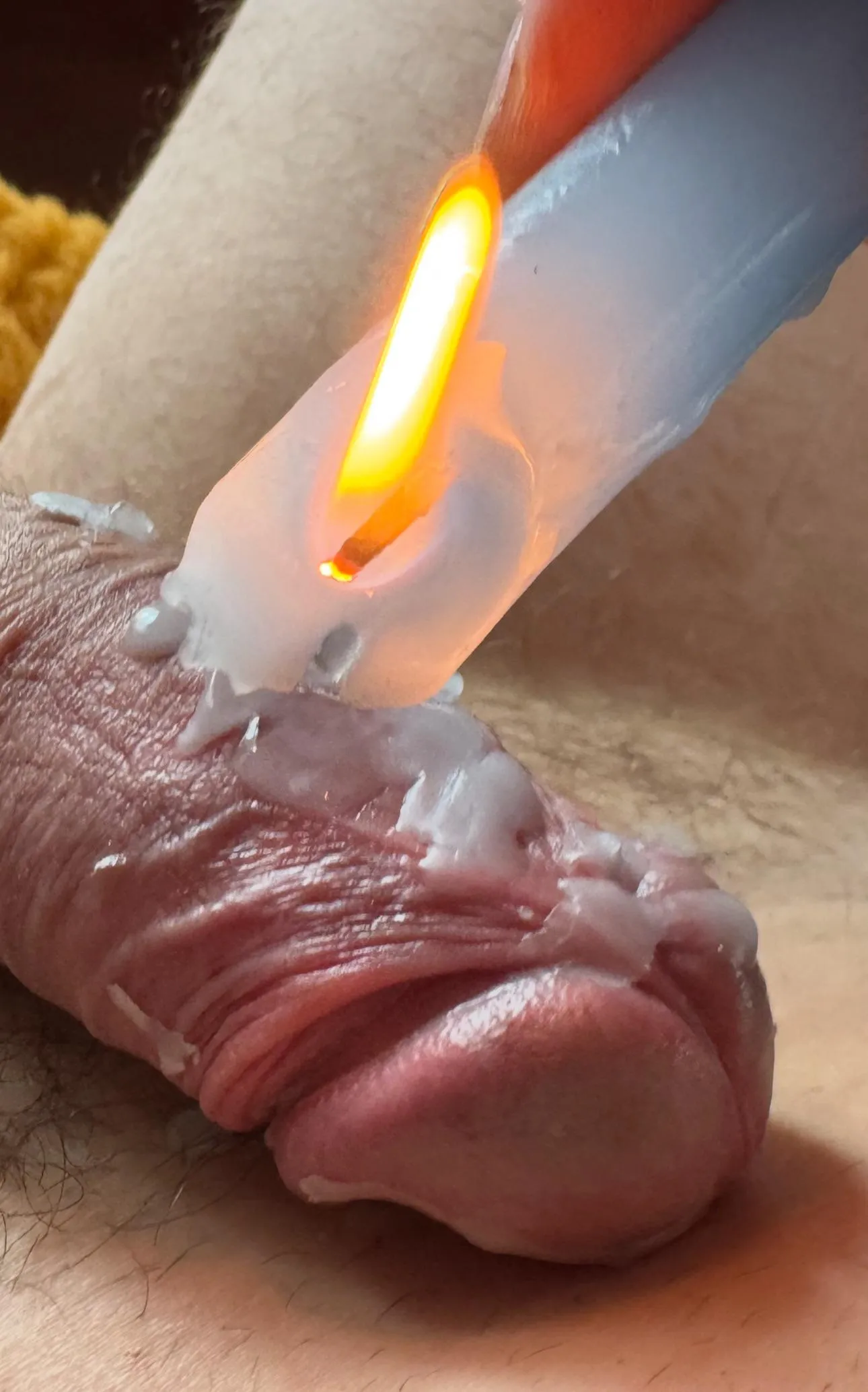 Encasing the cock