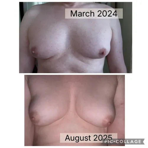 Currently at 8mg Estradiol and 100mg Progesterone