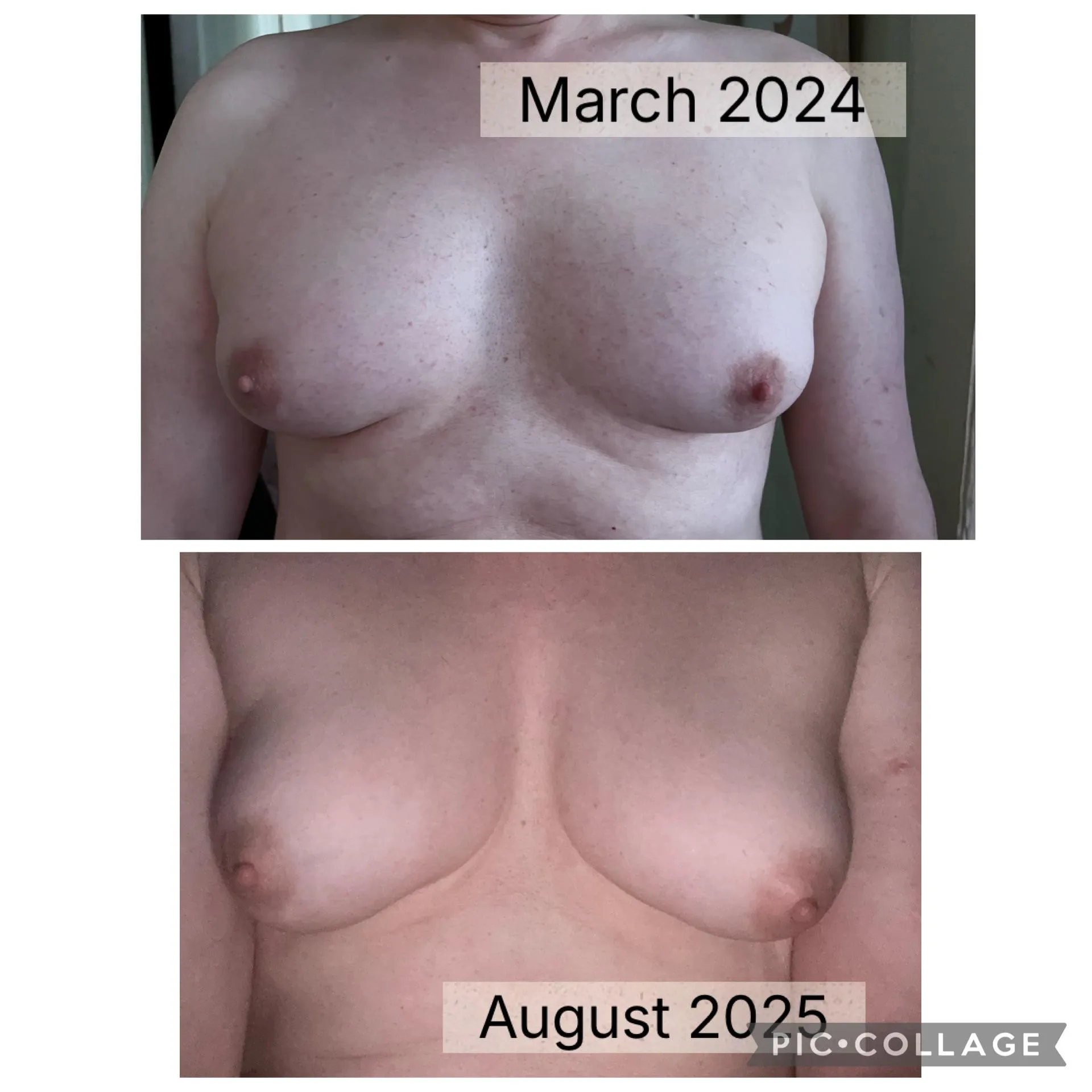 Currently at 8mg Estradiol and 100mg Progesterone