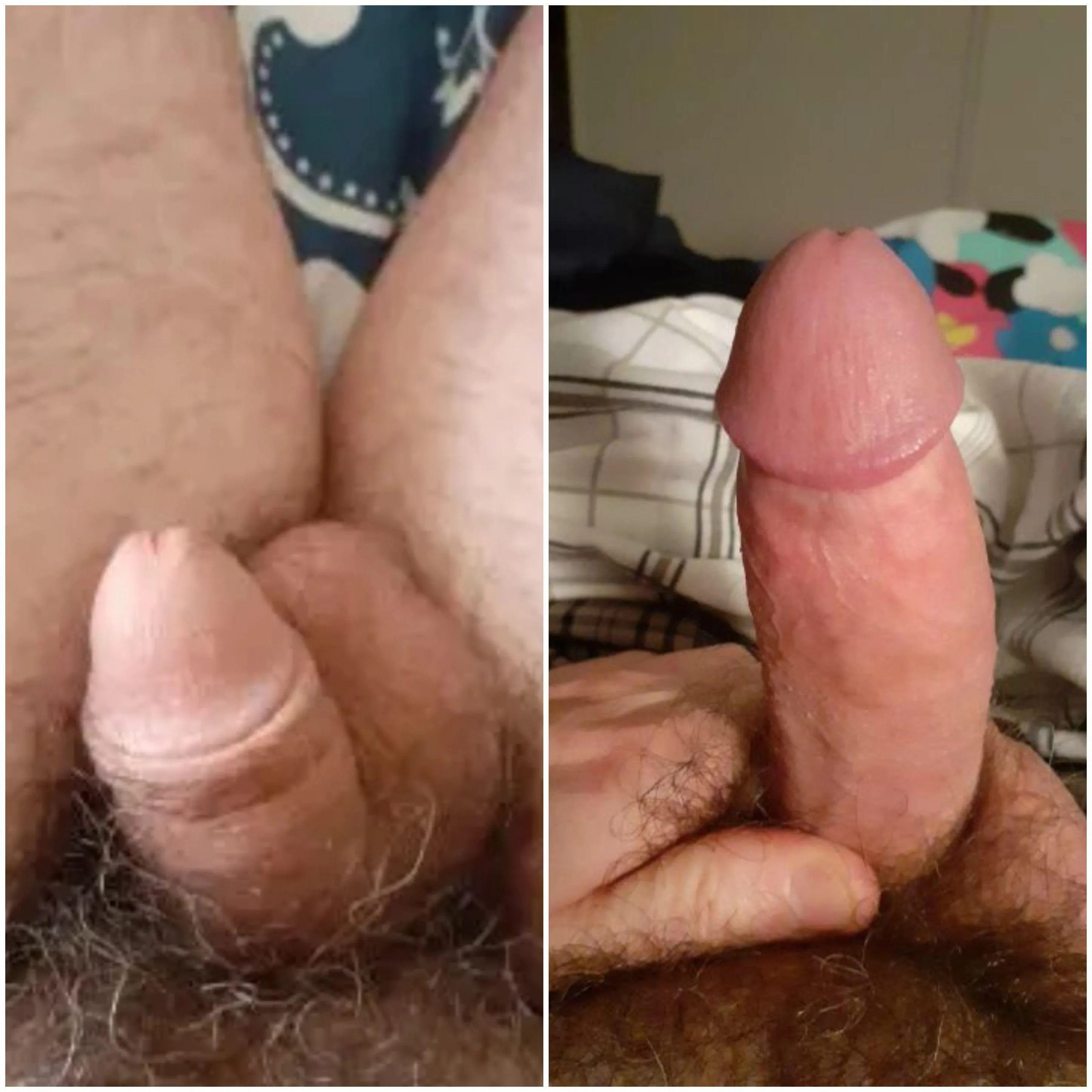 Growing makes my shaft skin tight!