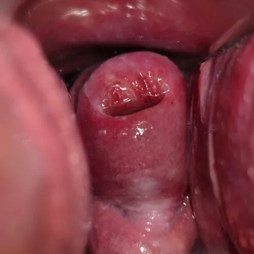 Close up of my cervix ❤️ (FTM)