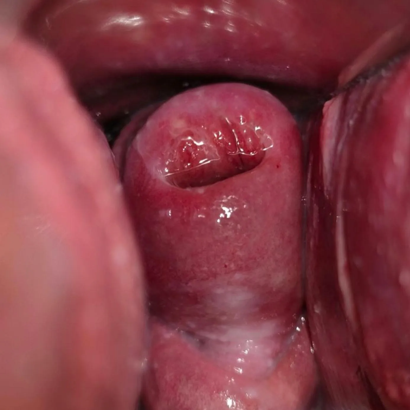 Close up of my cervix ❤️ (FTM)