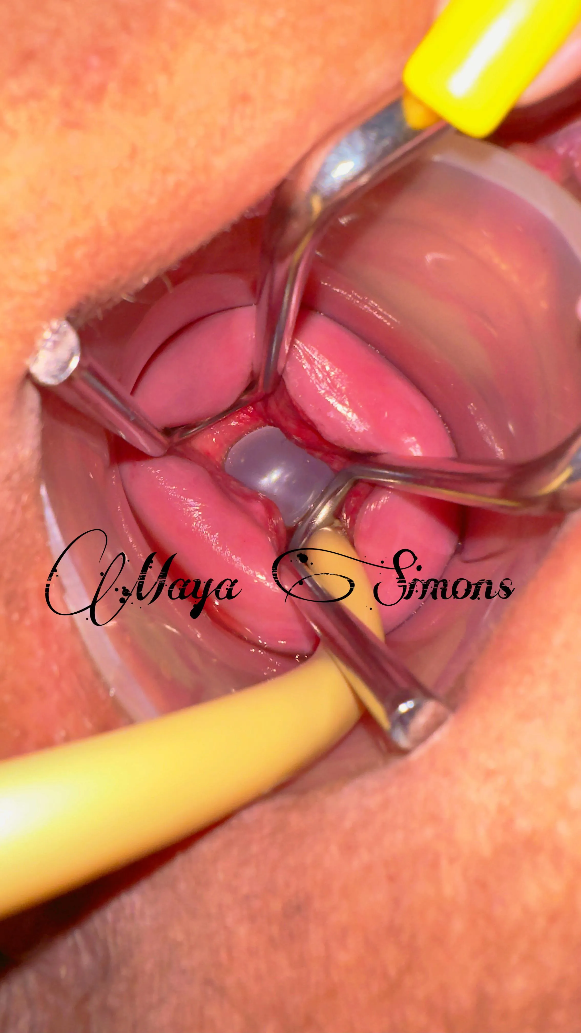 Extreme cervical gape stretch from the inside out, to eliminate that bottleneck 👑