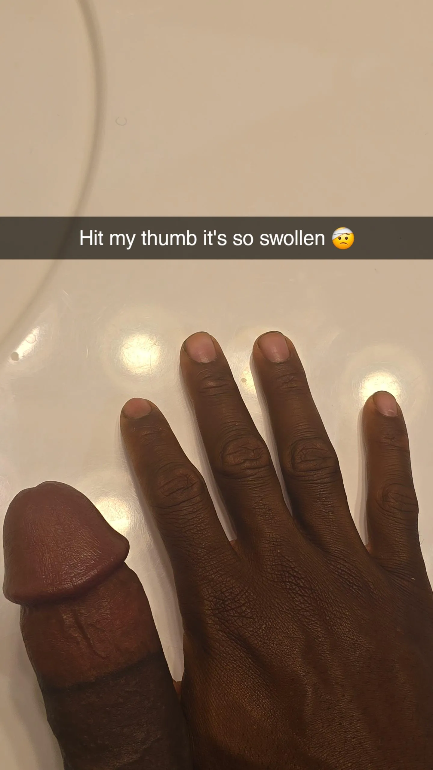 Thum is swollen 😫