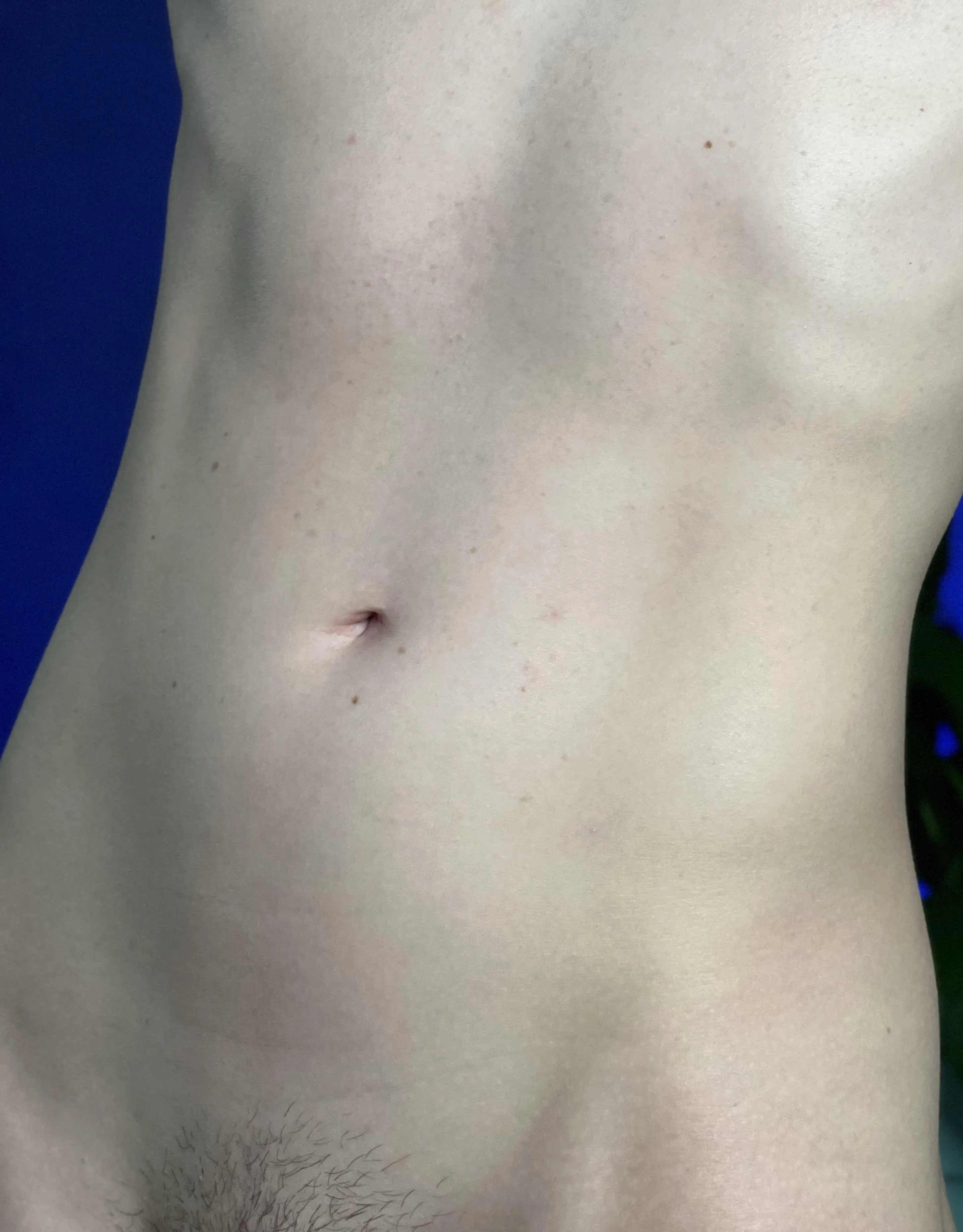 A soft place to land after the storm