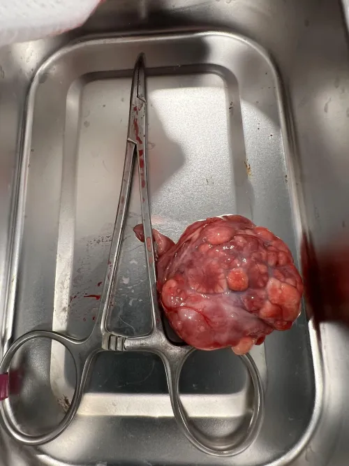 This 52g tumor removed from my 455g rat