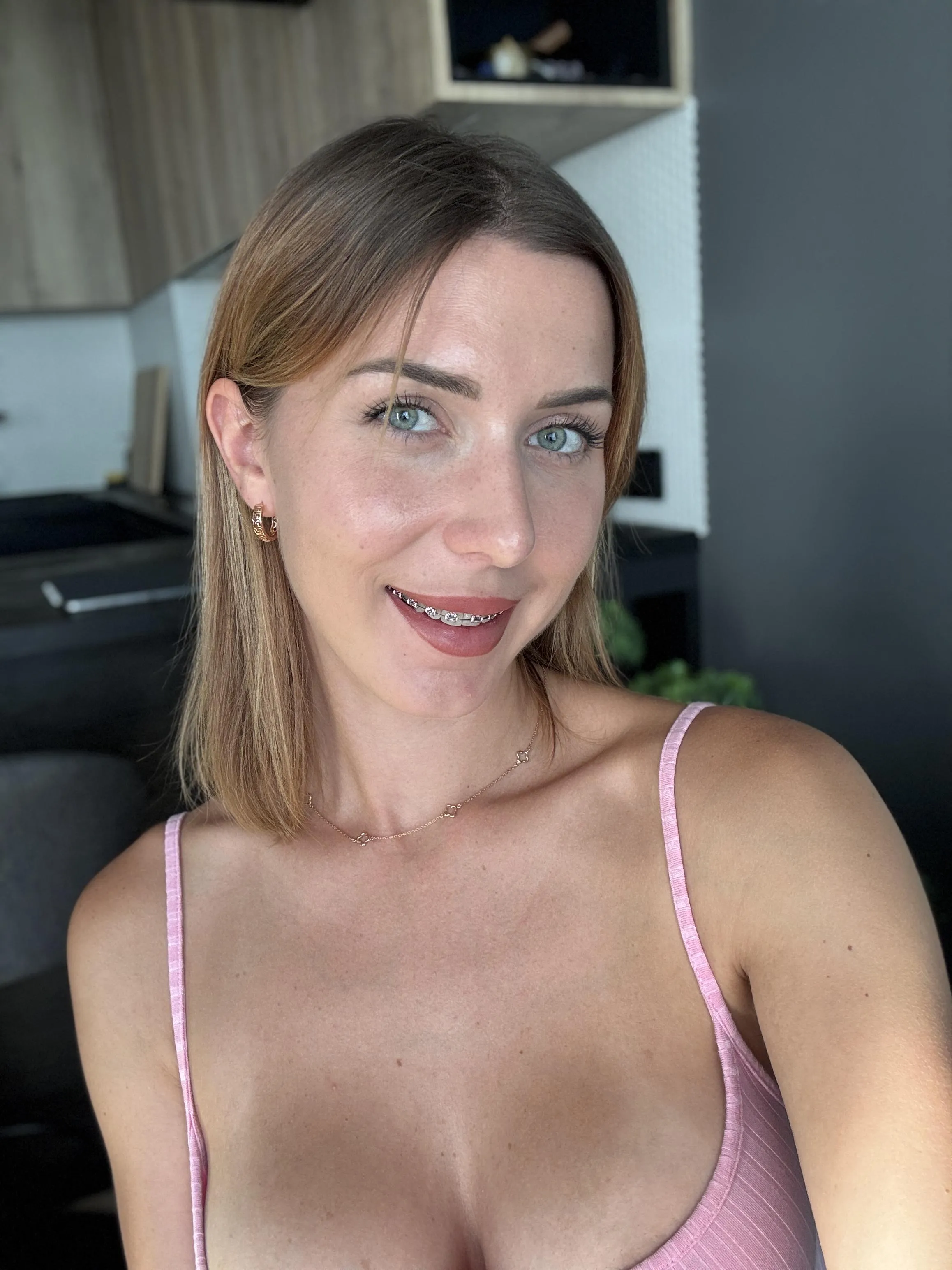 Do I look good with my braces