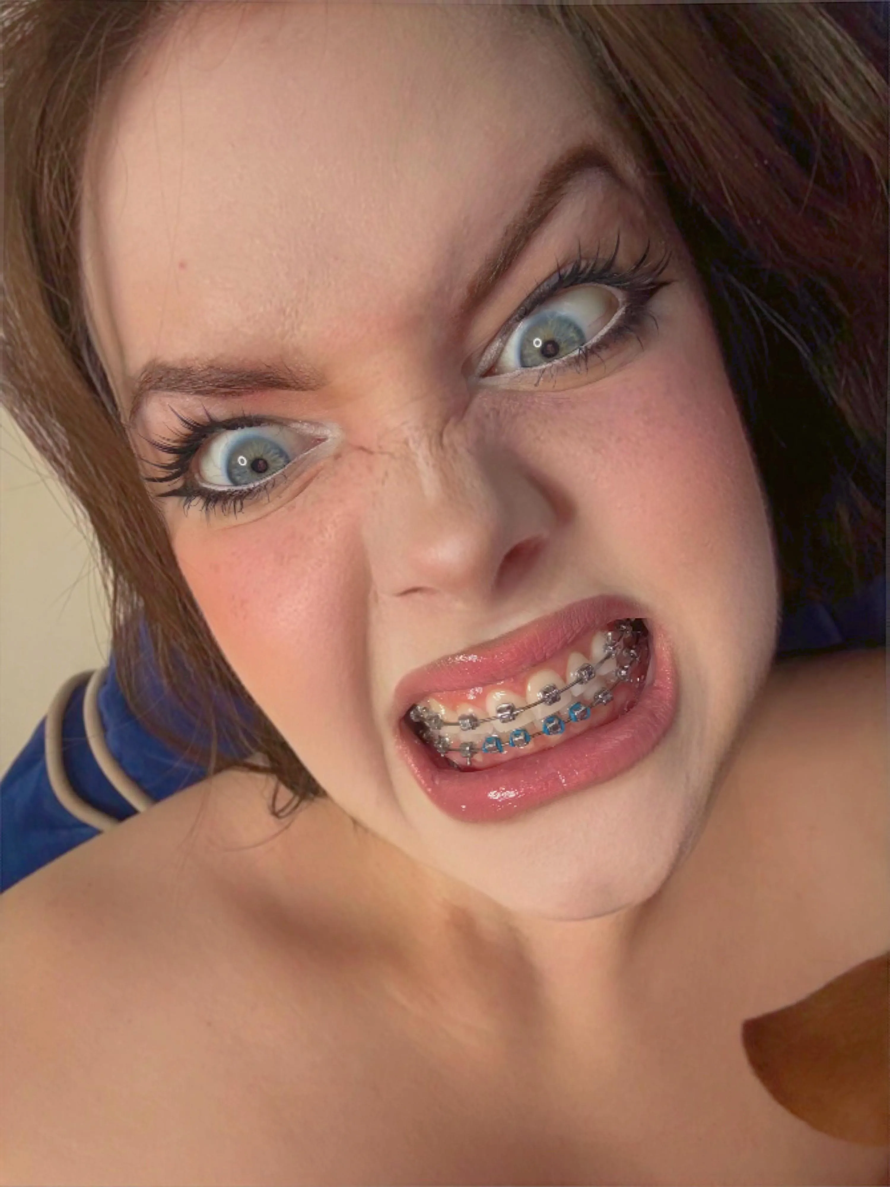 When someone asks to see my braces and I do it exactly like this