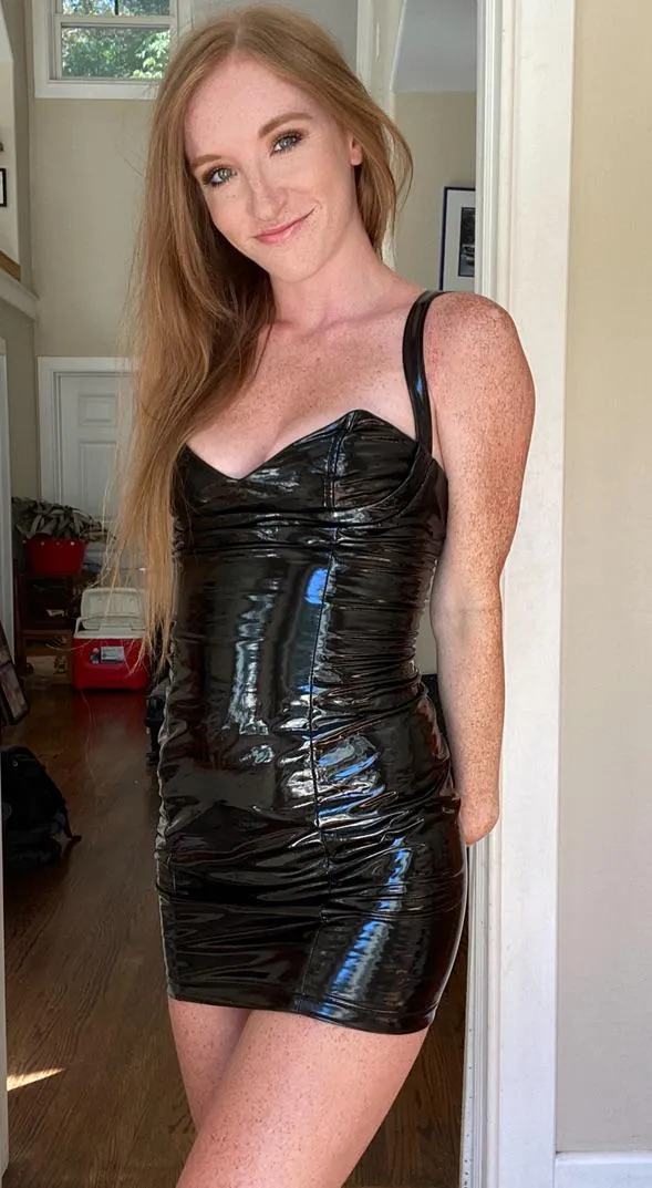 The freckles never stop [IRTR]