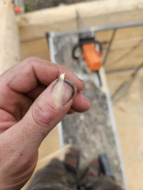 gnarly looking splinter