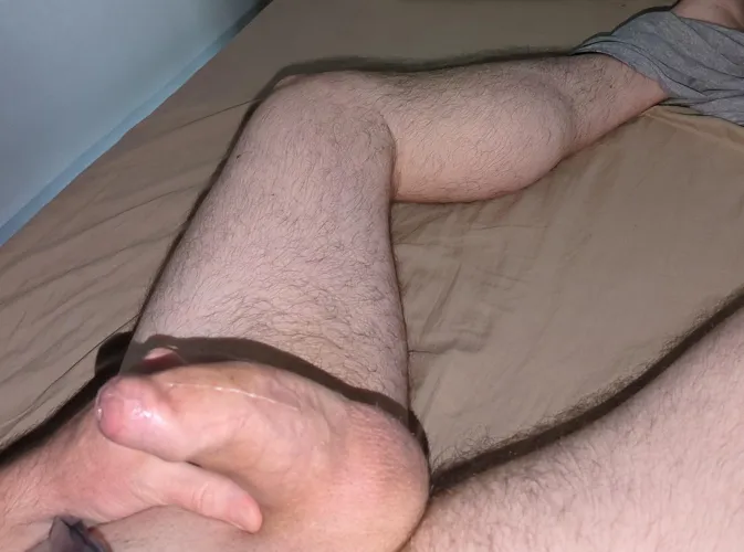 Chunky phimosis penis