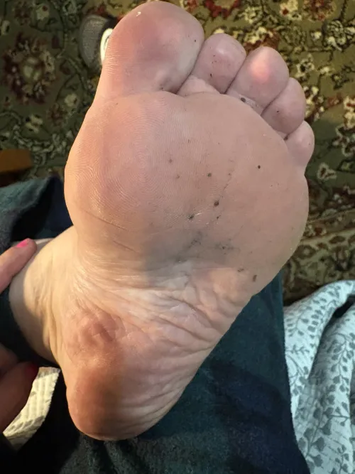 Ew , come clean them