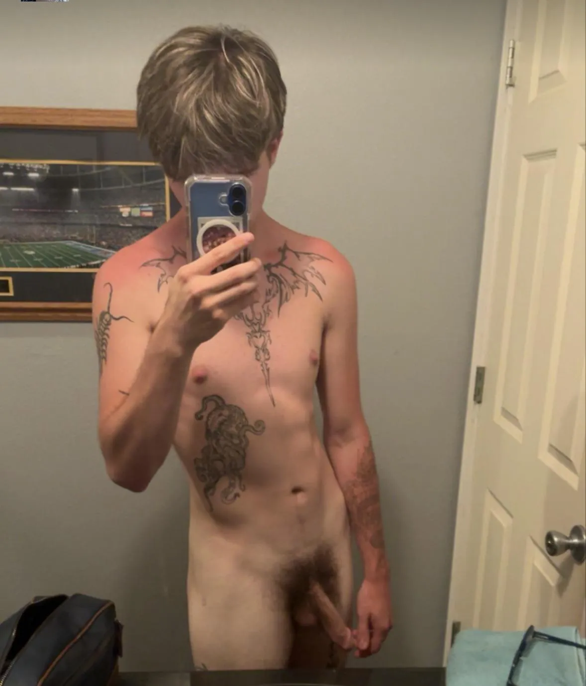 Burnt boy n his dick ;)