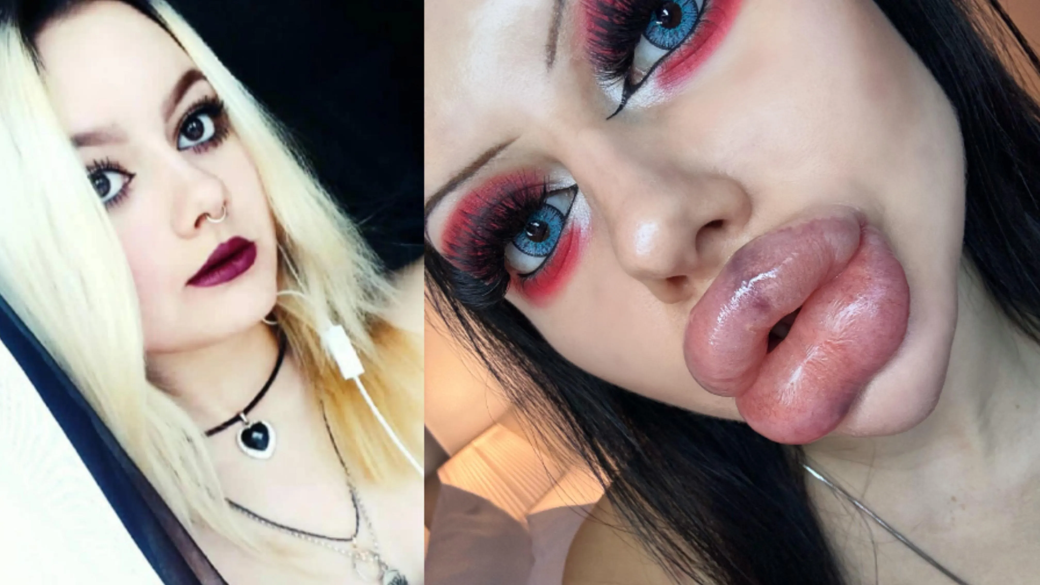 Before vs couple days ago after latest fill <3