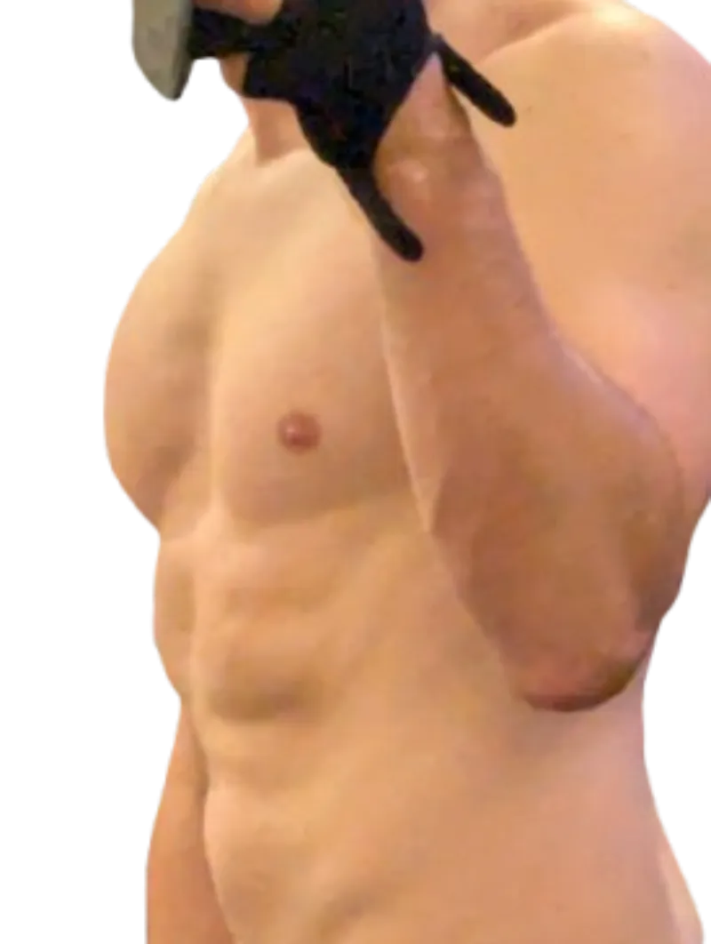 After a bad Accident I start training again slowly. 1,80m 85kg. What do you think?