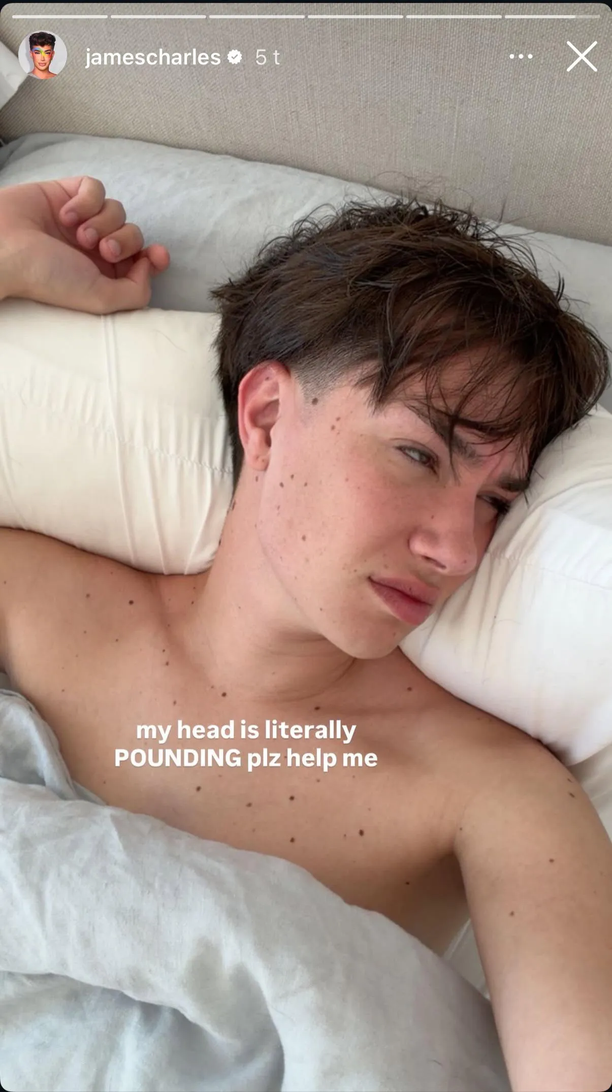 Poor James and his pounding head. 🥺💖