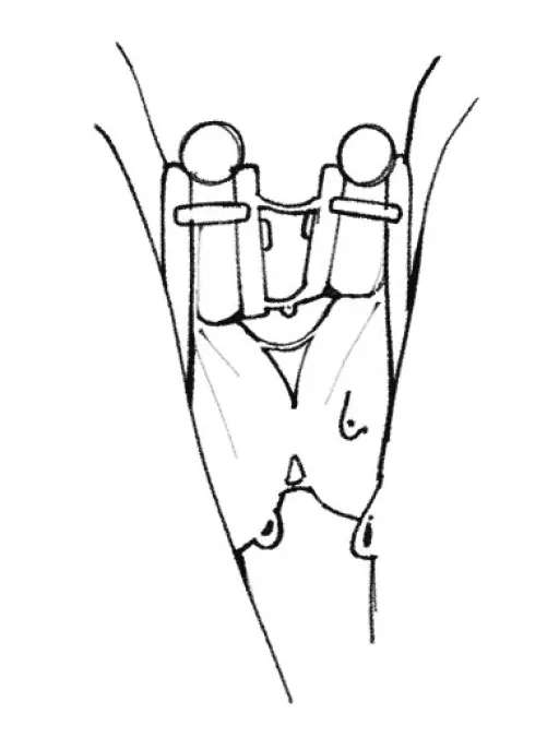 When femboys kissing