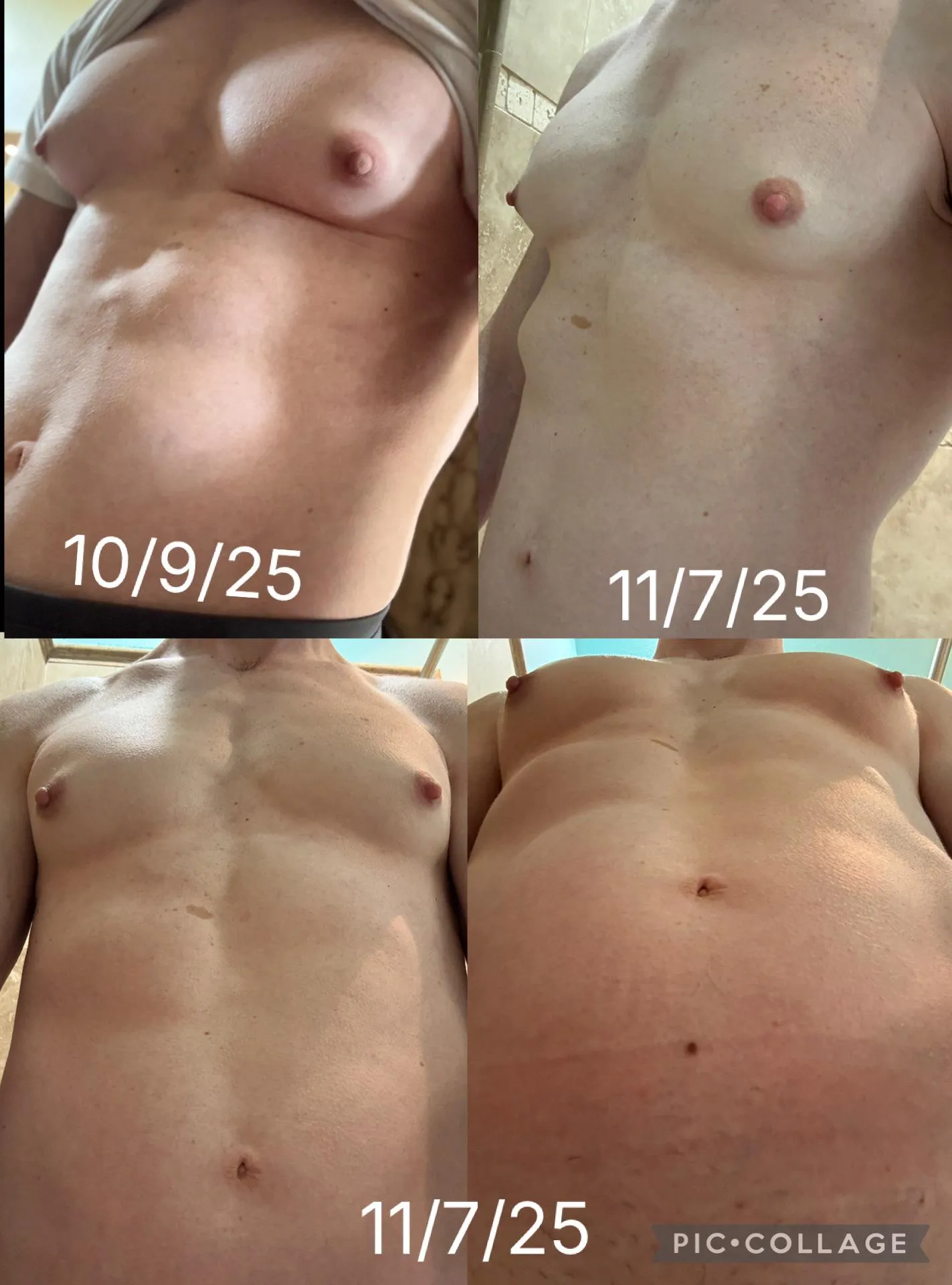 1 month on estrogen monotherapy: progress.