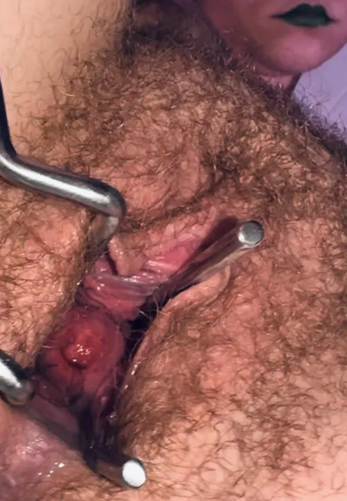 a clear view to my cervix…will you be gentle or rough with it?