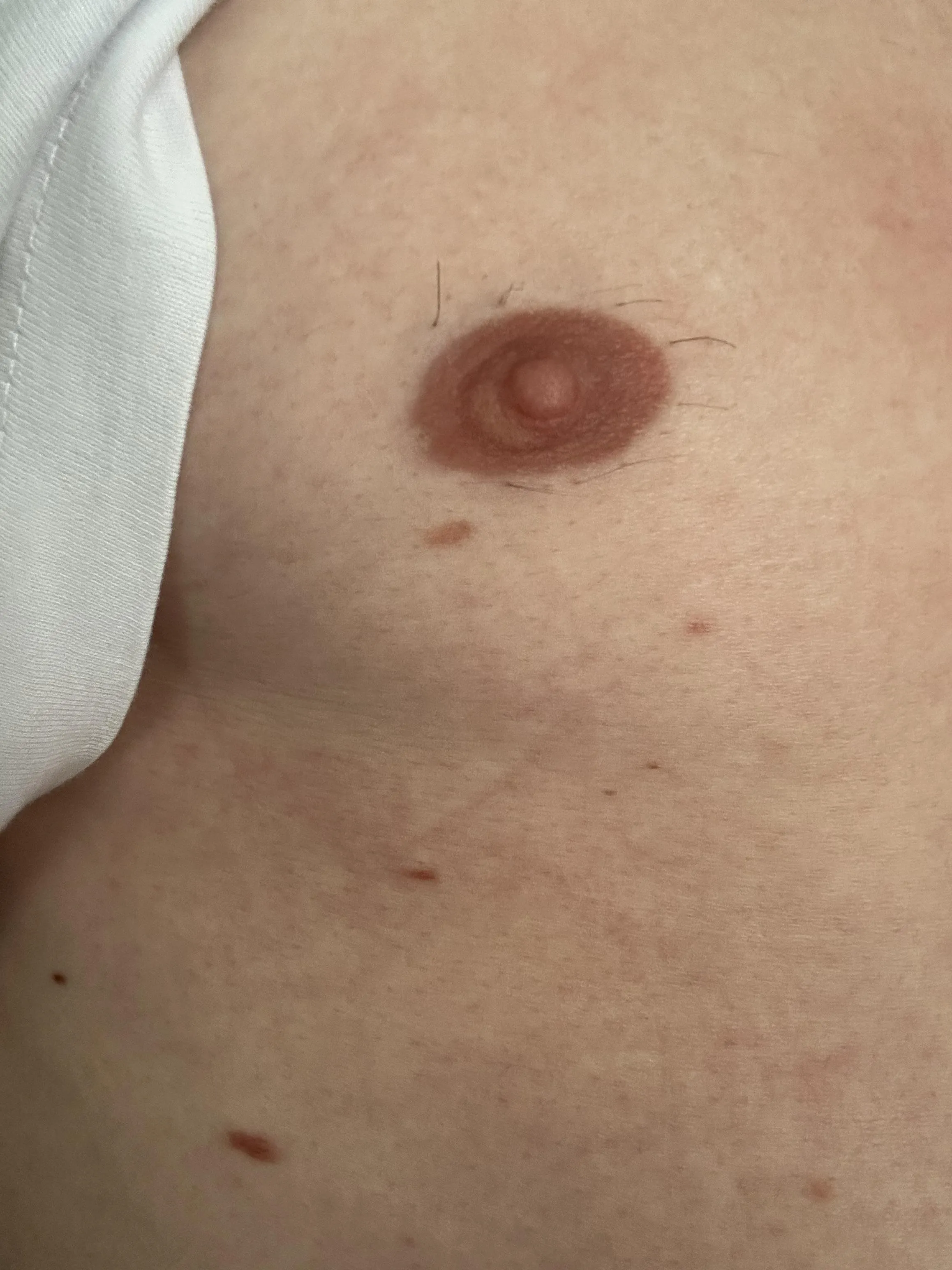 Is this a the beginning of breast growth?