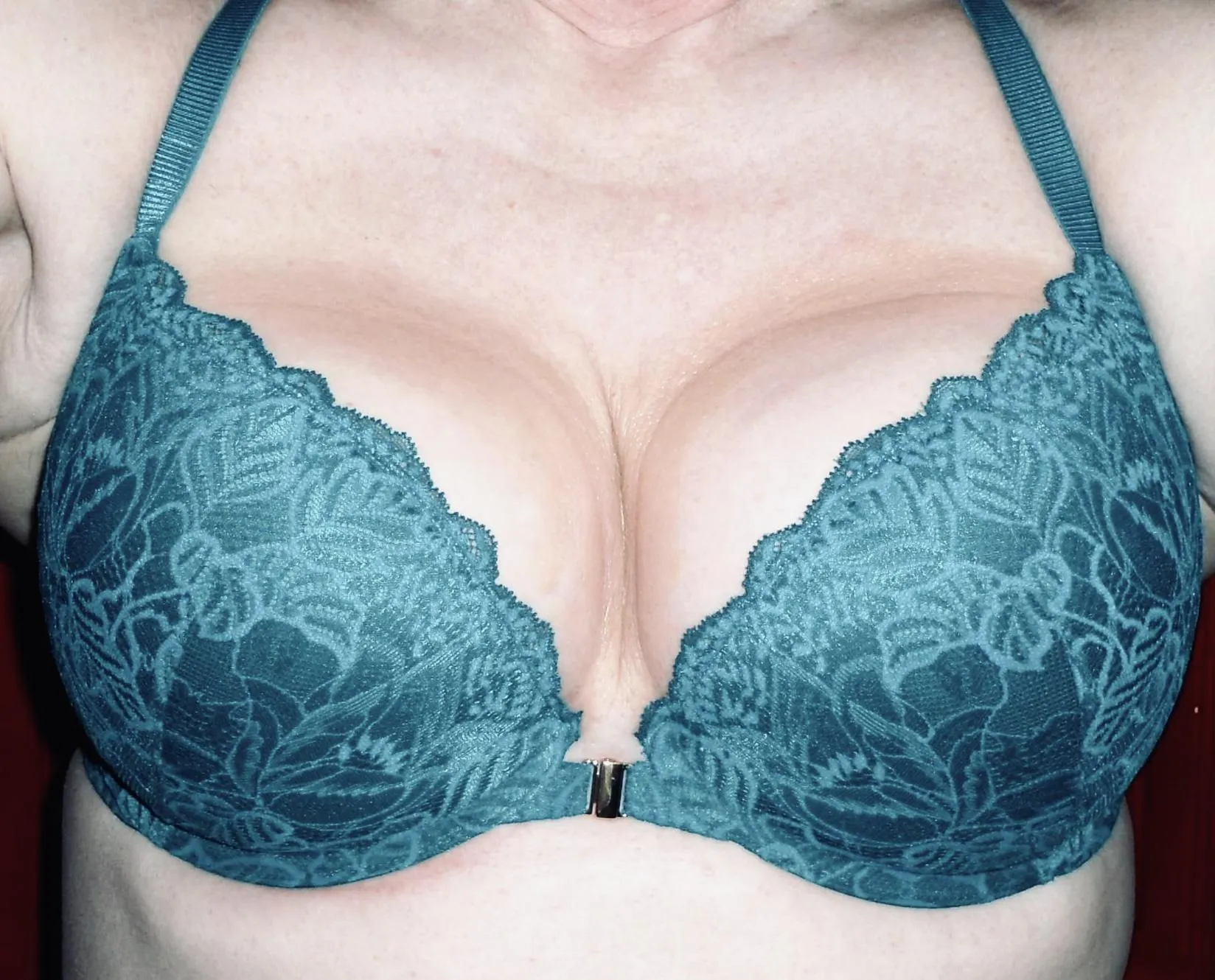 Is this bra appropriate for my dermatologist full body scan appointment today?