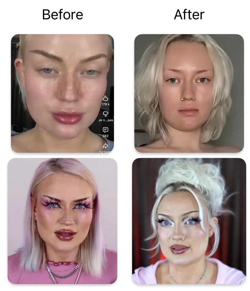 Less filler for a drastic transformation