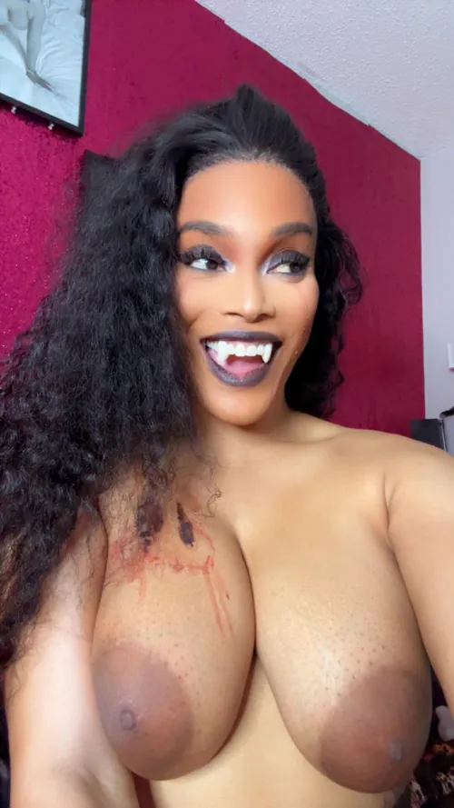 Post op TS Vampire in Chester