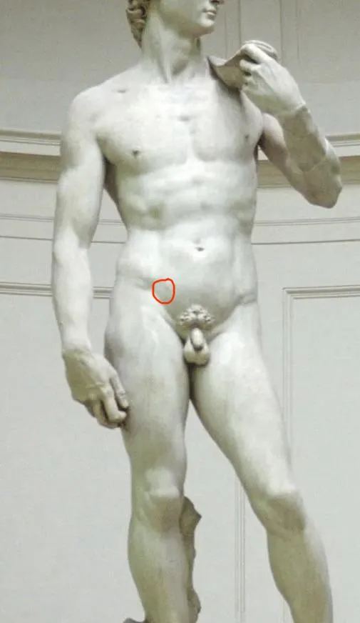 strained a ligament(?) above hip flexor compression hanging