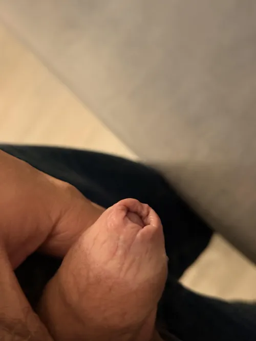 18m with phimosis (photo soft dick)