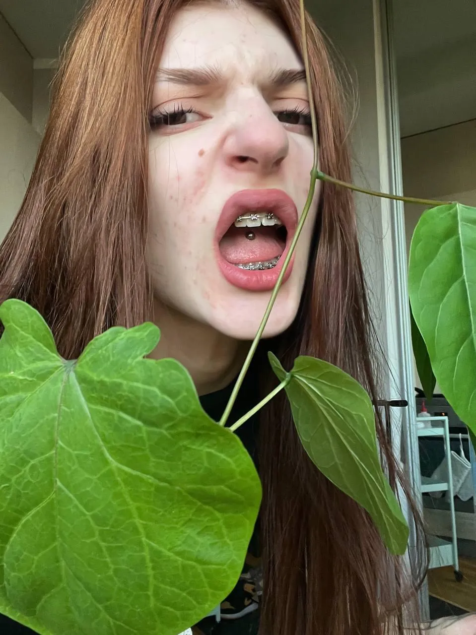 do braces on teens turn you on?