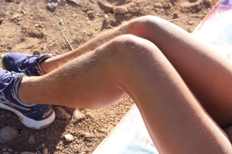 A beautiful day for beautiful hairy legs