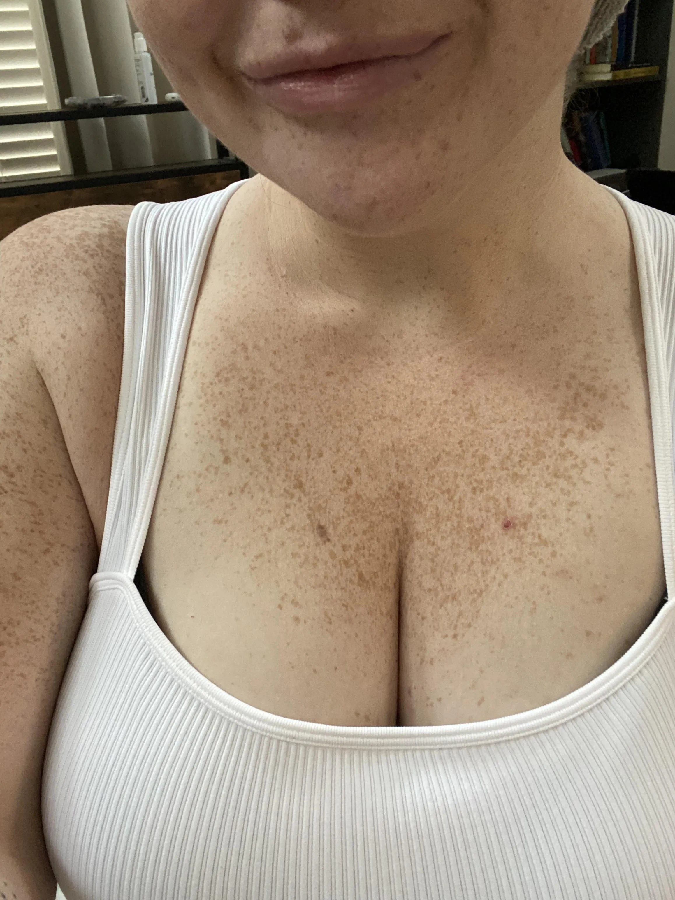 A constellation of freckles you keep getting lost in