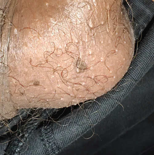 Can someone please tell me what these white spots and bumps are, they are very annoying to look at and is also ochu sometimes.