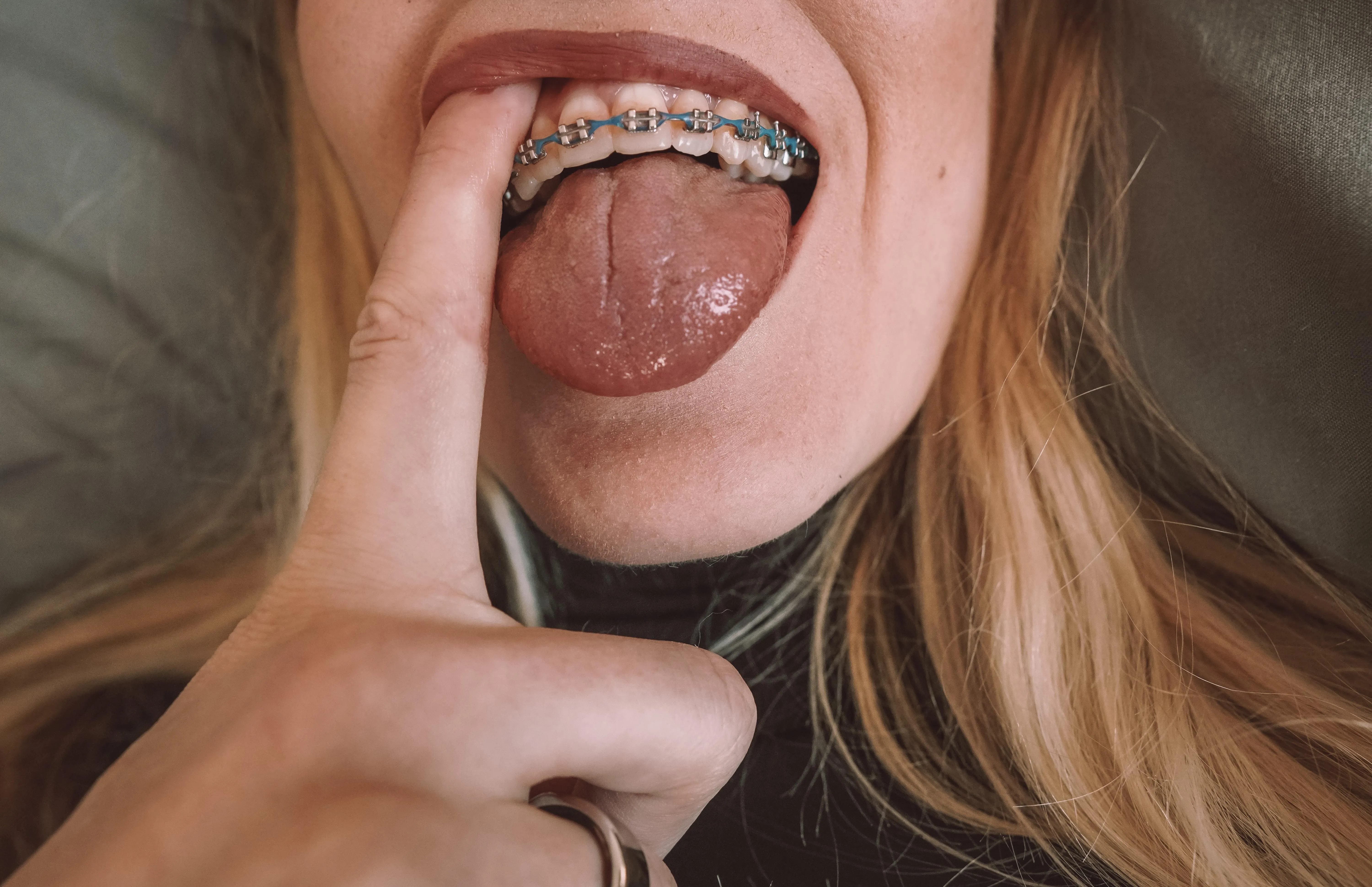 Can you turn my tongue white please