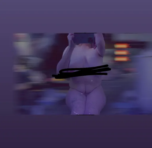 25f bilateral amputee, clubbed arm, read bottom text out of hospital again!